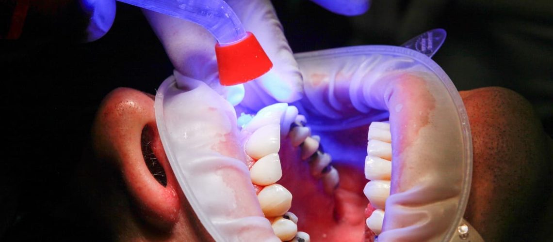 dentist-1864921_1280 (1)